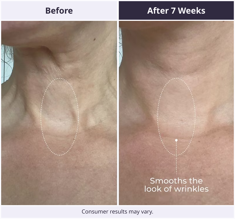 Tighten & Lift Neck Cream