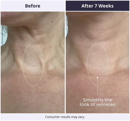 Tighten & Lift Neck Cream