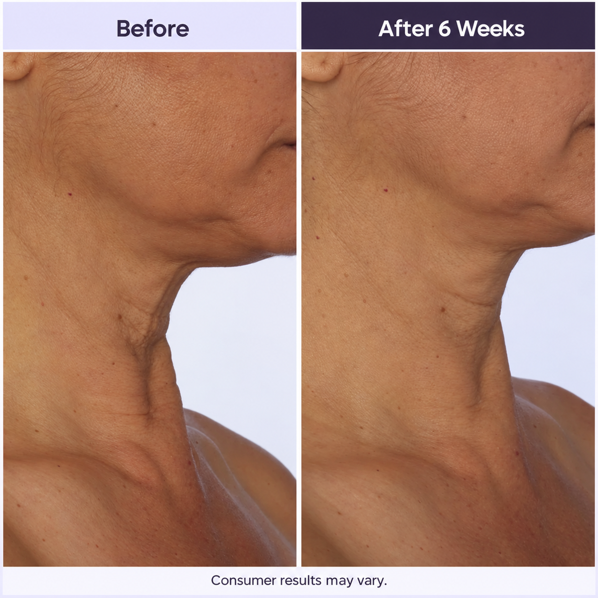 Tighten & Lift Neck Cream